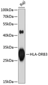 Anti-HLA-DRB3 antibody used in Western Blot (WB). GTX54087