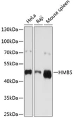 Anti-HMBS antibody used in Western Blot (WB). GTX54089