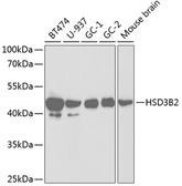 Anti-HSD3B2 antibody used in Western Blot (WB). GTX54092