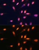 Anti-Histone H3K4me1 (mono-methyl Lys4) antibody used in Immunocytochemistry/ Immunofluorescence (ICC/IF). GTX54100