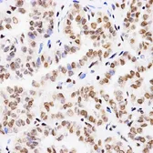 Anti-Histone H3K4me1 (mono-methyl Lys4) antibody used in IHC (Paraffin sections) (IHC-P). GTX54100