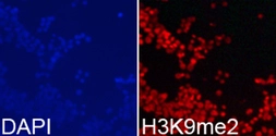 Anti-Histone H3K9me2 (di-methyl Lys9) antibody used in Immunocytochemistry/ Immunofluorescence (ICC/IF). GTX54102
