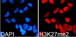 Anti-Histone H3K27me2 (di-methyl Lys27) antibody used in Immunocytochemistry/ Immunofluorescence (ICC/IF). GTX54105