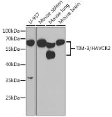 Anti-TIM-3 antibody used in Western Blot (WB). GTX54117