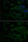 Anti-RACK1 antibody used in Immunocytochemistry/ Immunofluorescence (ICC/IF). GTX54122