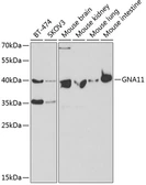 Anti-GNA11 antibody used in Western Blot (WB). GTX54123