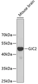 Anti-GJC2 antibody used in Western Blot (WB). GTX54126