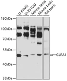 Anti-Glycine Receptor alpha 1 antibody used in Western Blot (WB). GTX54128
