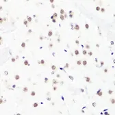 Anti-Histone H3R2me2 (Asymmetric Di-methyl Arg2) antibody used in IHC (Paraffin sections) (IHC-P). GTX54134