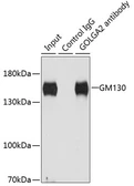 Anti-GM130 antibody used in Immunoprecipitation (IP). GTX54142