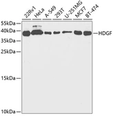 Anti-HDGF antibody used in Western Blot (WB). GTX54144