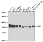Anti-GARS antibody used in Western Blot (WB). GTX54147