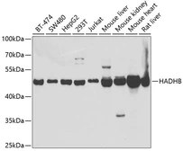 Anti-HADHB antibody used in Western Blot (WB). GTX54152