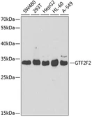 Anti-GTF2F2 antibody used in Western Blot (WB). GTX54156