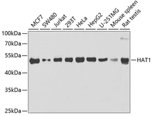 Anti-HAT1 antibody used in Western Blot (WB). GTX54158