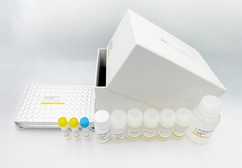 Respiratory Syncytial Virus Nucleoprotein ELISA Kit. GTX542454