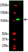 Anti-Ret antibody used in Western Blot (WB). GTX54247