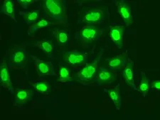 Anti-MPG antibody used in Immunocytochemistry/ Immunofluorescence (ICC/IF). GTX54286