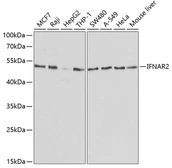 Anti-IFNAR2 antibody used in Western Blot (WB). GTX54289