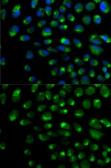 Anti-IFNAR2 antibody used in Immunocytochemistry/ Immunofluorescence (ICC/IF). GTX54289