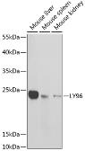 Anti-MD2 antibody used in Western Blot (WB). GTX54290