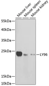 Anti-MD2 antibody used in Western Blot (WB). GTX54290
