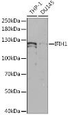 Anti-MDA5 antibody used in Western Blot (WB). GTX54300