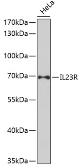 Anti-IL23 Receptor antibody used in Western Blot (WB). GTX54301