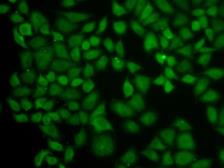 Anti-SRP1 antibody used in Immunocytochemistry/ Immunofluorescence (ICC/IF). GTX54302