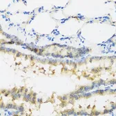 Anti-IL28B antibody used in IHC (Paraffin sections) (IHC-P). GTX54305