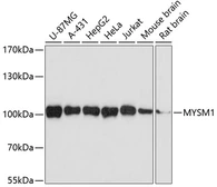 Anti-MYSM1 antibody used in Western Blot (WB). GTX54308