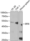 Anti-IRF8 antibody used in Western Blot (WB). GTX54312