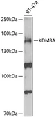 Anti-KDM3A antibody used in Western Blot (WB). GTX54313