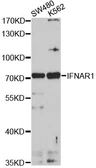 Anti-IFNAR1 antibody used in Western Blot (WB). GTX54322