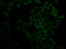 Anti-Moesin antibody used in Immunocytochemistry/ Immunofluorescence (ICC/IF). GTX54327