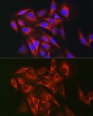 Anti-KEAP1 antibody used in Immunocytochemistry/ Immunofluorescence (ICC/IF). GTX54329