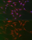 Anti-KEAP1 antibody used in Immunocytochemistry/ Immunofluorescence (ICC/IF). GTX54329