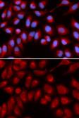 Anti-IL16 antibody used in Immunocytochemistry/ Immunofluorescence (ICC/IF). GTX54334