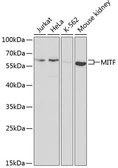 Anti-MITF antibody used in Western Blot (WB). GTX54344