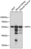 Anti-MPP1 antibody used in Western Blot (WB). GTX54346