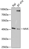 Anti-MVK antibody used in Western Blot (WB). GTX54347