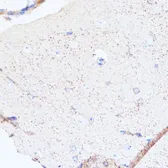 Anti-Monoamine Oxidase A antibody used in IHC (Paraffin sections) (IHC-P). GTX54351