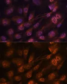 Anti-MEK7 antibody used in Immunocytochemistry/ Immunofluorescence (ICC/IF). GTX54352