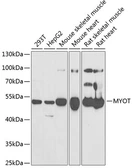 Anti-Myotilin antibody used in Western Blot (WB). GTX54355