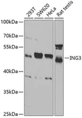 Anti-ING3 antibody used in Western Blot (WB). GTX54356