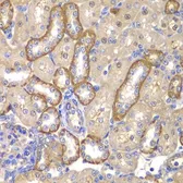 Anti-MMP14 antibody used in IHC (Paraffin sections) (IHC-P). GTX54361