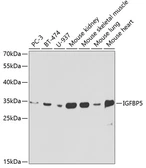 Anti-IGFBP5 antibody used in Western Blot (WB). GTX54362