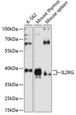 Anti-IL2 Receptor gamma antibody used in Western Blot (WB). GTX54363