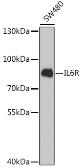 Anti-IL6 Receptor antibody used in Western Blot (WB). GTX54364