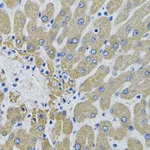 Anti-MBL2 antibody used in IHC (Paraffin sections) (IHC-P). GTX54368